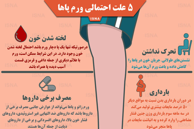 اینفوگرافی / پنج علت احتمالی ورم پاها