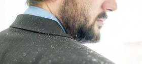 بهترین روش‌های درمان شوره سر