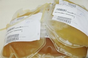 نیاز کلانشهرها به پلاسمای بهبود یافتگان کرونا / درخواست اهدای خون همه گروه‌های خونی