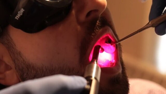 استفاده از لیزر در درمان بیماری‌های ارولوژی و زخم‌های دهانی