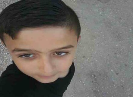 شلیک گلوله انفجاری تک‌تیرانداز رژیم صهیونیستی به پیشانی کودک ۱۰ ساله فلسطینی 