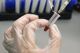 ذخیره سازی ۱۳۳هزار نمونه در بانک خون بندناف رویان جهاددانشگاهی