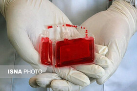 رشد ۱۳ درصدی ذخیره‌سازی خون بند ناف در جهاددانشگاهی استان مرکزی