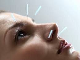 تأثیر طب سوزنی در درمان چین و چروک صورت