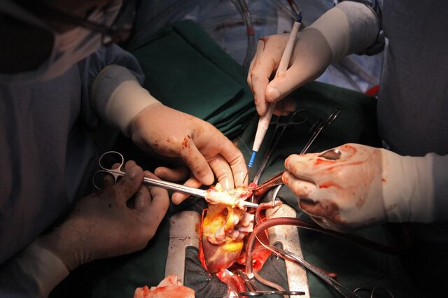 انتقال یک قلب از یزد به تهران برای پیوند به جوان 23 ساله + عکس