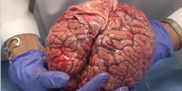 عکس دریافتی است ضرورت ایجاد کمیته علمی بانک مغز/پروژههای کاربردی در مرکز بانک مغز ایران انجام شود