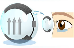 توسعه لنزهای تماسی مبتنی بر باتری و دارای قابلیت خود مرطوب کنندگی