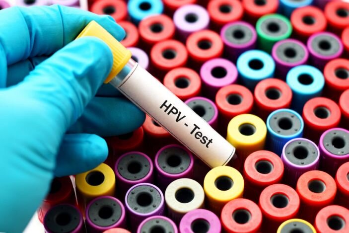 نرخ ۵ تا ۹ درصدی ابتلا به HPV در کشور/تاثیر آلودگی هوا در فوت زودتر شهروندان