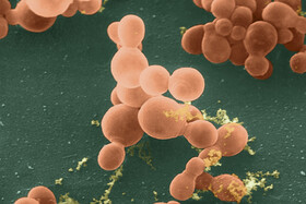 احتمال درمان سرطان با کمک نوعی قارچ