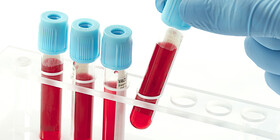 انتخاب "بانک سلول‌های بنیادی خون قاعدگی" به‌عنوان دستاورد برتر