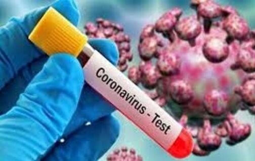 عدم ابتلای مجدد افراد به کرونا ثابت شده نیست/آغاز پلاسما درمانی برای درمان بیماری کووید۱۹