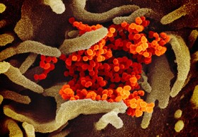 آزمایش خانگی "دانشگاه استنفورد" برای شناسایی "کروناویروس"