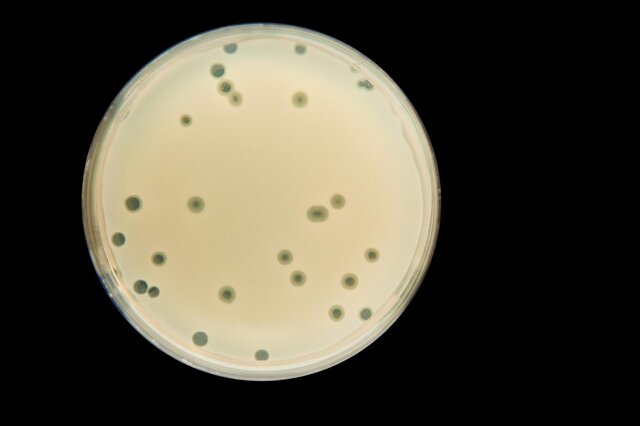 جنگ باکتری‌ها و ویروس‌ها، چالش جدید حوزه زیست‌فناوری