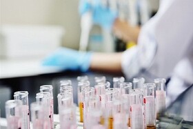 تاخیر دولت انگلیس در تایید آزمایشات پلاسما درمانی برای بیماران کووید-۱۹