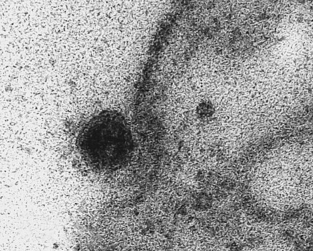 لحظه‌ی آلوده شدن سلول‌های سالم به "کروناویروس" ثبت شد+تصاویر