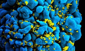 درمان ایدز با کمک یک مولکول نادر