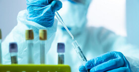 جزئیات کارآزمایی‌های بالینی سلول‌های مزانشیمی در درمان مبتلایان به کووید-۱۹