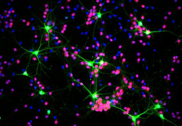 ژنی که فعالیت الکتریکی نورون‌های مغز را کنترل می‌کند