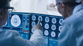 شناسایی "تومور مغزی" با هوش مصنوعی شرکت اینتل