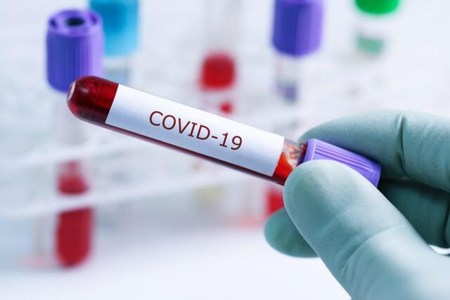 تاثیر برخی آنتی بادی ها در درمان کووید-۱۹