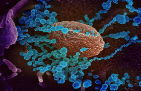 کاهش مرگ‌ومیر ناشی از کرونا ویروس با نانو فناوری