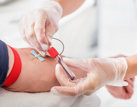 ضرورت اهدای خون در تقویت روند مقابله با بیماری کووید-۱۹