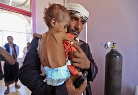 یونیسف: تا پایان ۲۰۲۰ شمار کودکان یمنی مبتلا به سوءتغذیه به بیش از ۲ میلیون می‌رسد