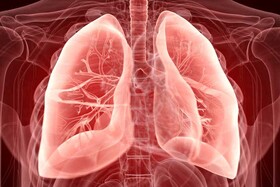 میزان آسیب‌پذیری ریه‌ افراد مبتلا به کووید-۱۹ پس از بهبودی