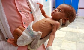 "۲۵ درصد خانواده‌های یمنی در معرض قحطی و گرسنگی هستند"