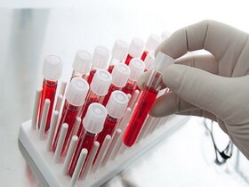 ثبت بیش از ۹هزار نمونه در مرکز پذیره‌نویسی سلول‌های بنیادی خون‌سازِ "محک"