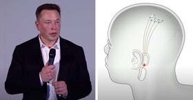 "ایلان ماسک" در یک رویداد زنده اطلاعات جدیدی درباره "نورالینک" فاش می‌کند