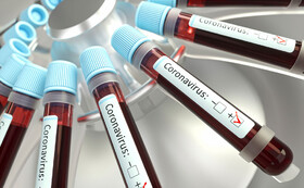ویروس موجود در خون می‌تواند کووید-۱۹ حاد را پیش‌بینی کند