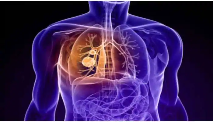 تشخیص به موقع سرطان ریه با کمک یک مولکول کوچک