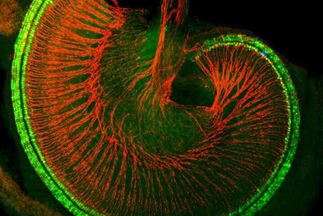 کشف پروتئینی که در رشد "سلول‌های مویی" گوش نقش دارد