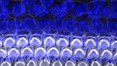 کشف پروتئینی که در رشد "سلول‌های مویی" گوش نقش دارد