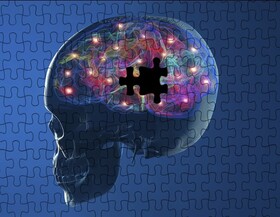 بهبود عملکرد نانوحسگرهای بررسی فعالیت دوپامین در مغز