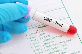 وبینار «تعریف،طبقه بندی و اپروچ به کم خونی در تست cbc» برگزار می شود