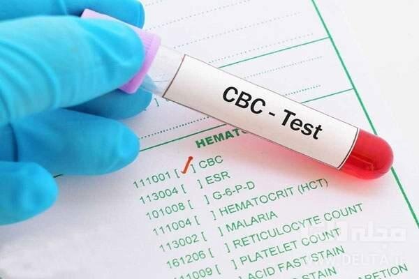 وبینار «تعریف،طبقه بندی و اپروچ به کم خونی در تست cbc» برگزار می شود