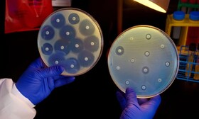 عصاره شوید کوهی؛ گزینه‌ای برای ساخت آنتی‌بیوتیک‌های جدید