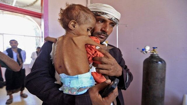 برنامه جهانی غذا: گرسنگی میلیون‌ها خانواده یمنی را تهدید می‌کند
