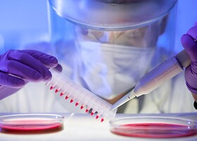 برگزاری نشست «کشت سلول های بنیادی»