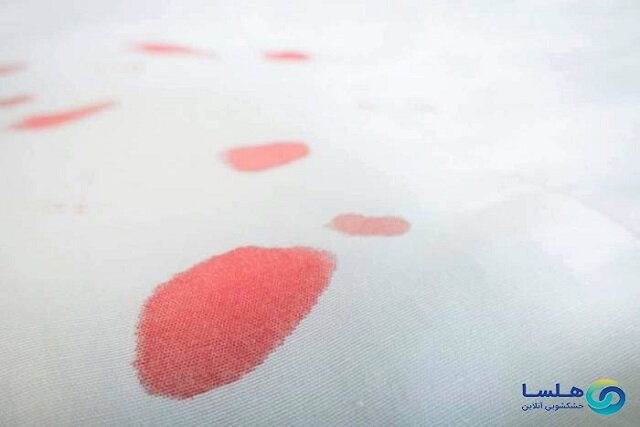 پاک کردن لکه انار و هندوانه در شب یلدا