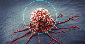 علایم و درمان سومین سرطان شایع زنان / مردان هم می‌توانند واکسن HPV بزنند