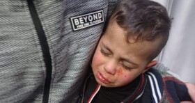 زخمی شدن کودک فلسطینی توسط شهرک نشینان صهیونیست
