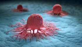 سلول‌های تومور که در بدن بیماران مبتلا به سرطان ریه مخفی می‌شوند