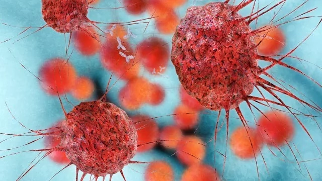 بررسی دقیق فرایند متاستاز سلول‌های سرطانی