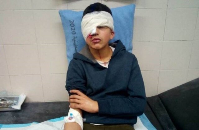 نوجوان فلسطینی به ضرب گلوله صهیونیست‌ها بینایی خود را از دست داد