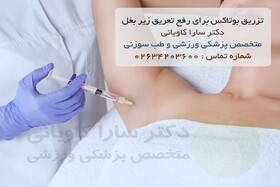 تزریق بوتاکس برای رفع تعریق