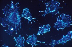 پروتئین‌هایی که می‌توانند درمان سرطان ریه باشند