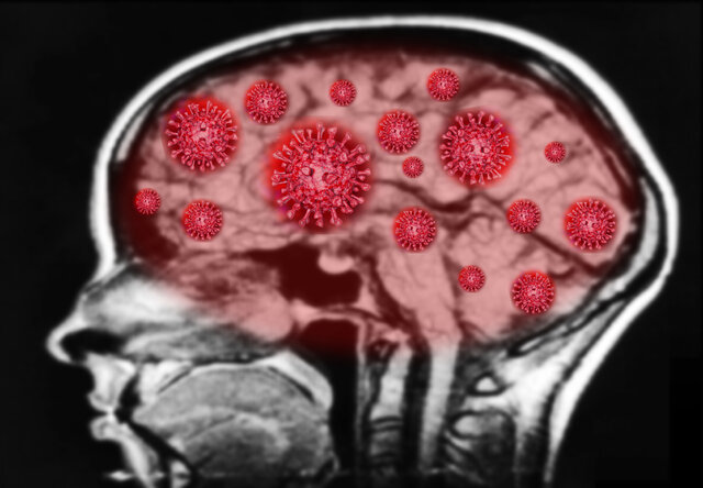کروناویروس می‌تواند به مغز آسیب بزند